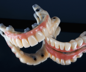 <img src="/images/chirurgia-guidata.jpg" alt="Chirurgia computer guidata per impianti dentali su arcata completa" /> 