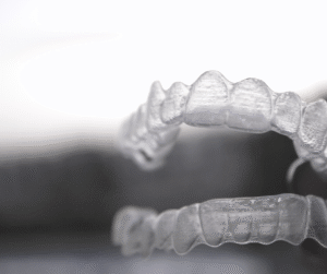 Ortodonzia invisibile con allineatori trasparenti per correggere malocclusioni dentali in modo preciso, estetico e confortevole.