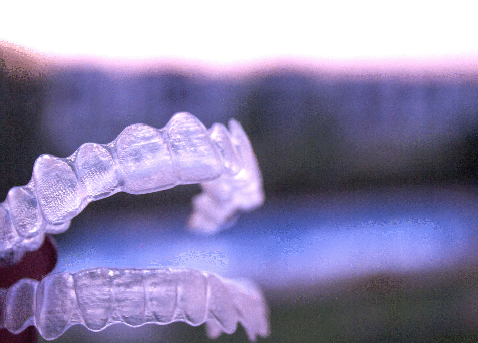 Allineatori trasparenti: la soluzione discreta per allineare i denti a ogni età