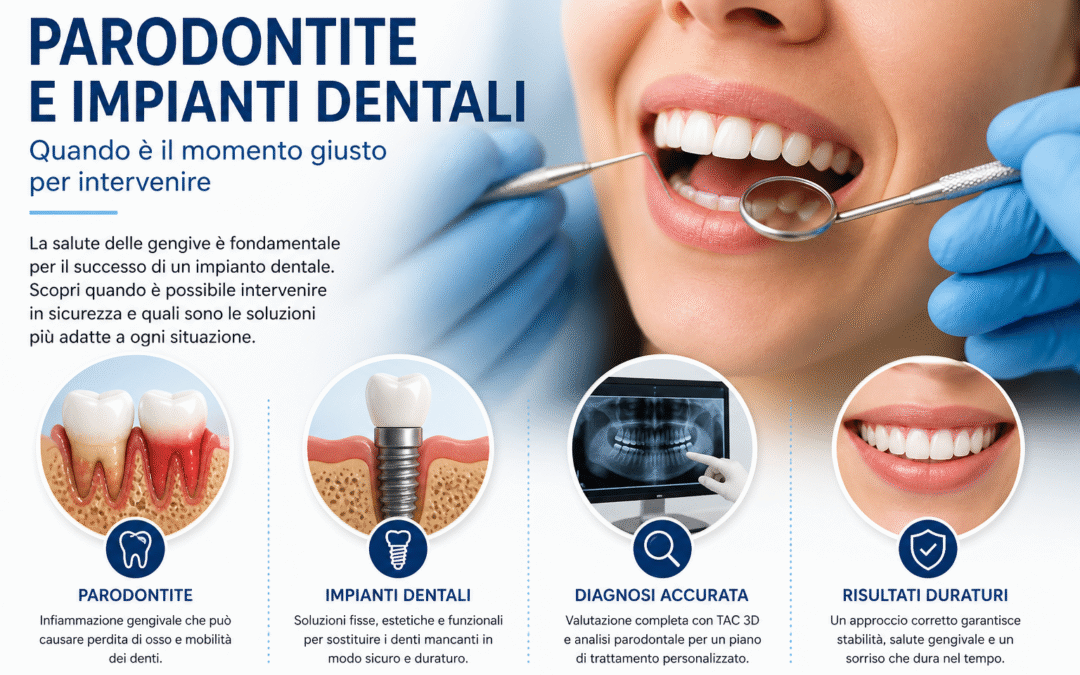 Parodontite e impianti dentali a Benevento: quando è il momento giusto per farli