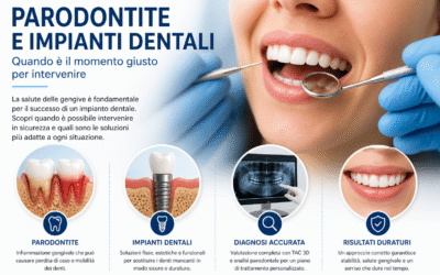 Parodontite e impianti dentali a Benevento: quando è il momento giusto per farli