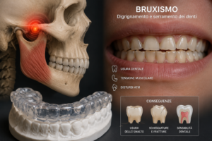 bruxismo-usura-denti-articolazione-temporo-mandibolare.jpg