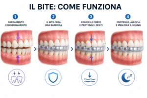 bite-bruxismo-funzionamento-protezione-denti.jpg